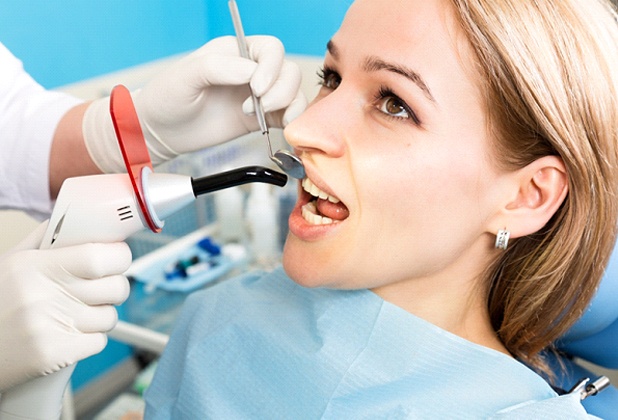 Dentist curing composite resin in Beverly Hills