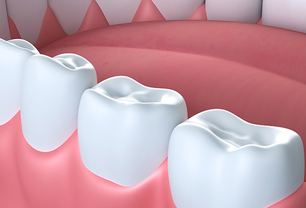 Closeup of teeth after dental sealant placement